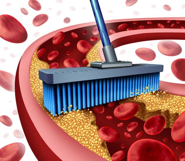 「胆固醇」钟南山分享早餐，鸡蛋被点名，而很多老人担心胆固醇高，不敢吃