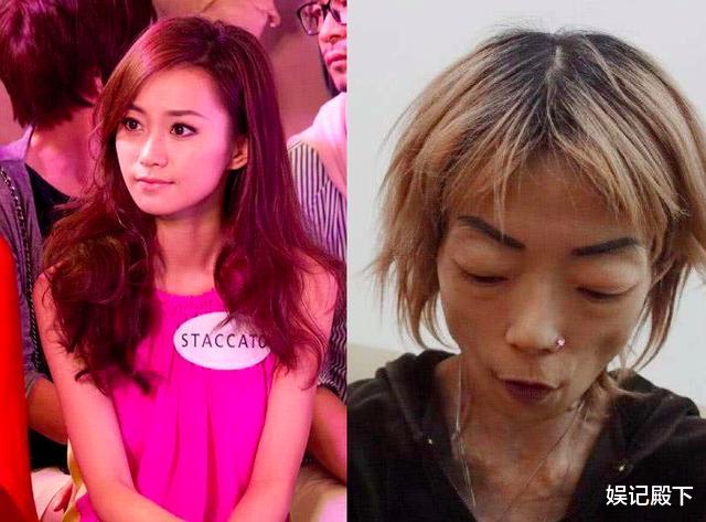 香港|她艳绝香港,因丈夫一句话全身瘫痪似骷髅,牙肉腐蚀脱落惨遭抛弃