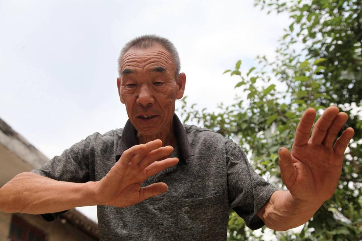 阿尔茨海默病|日本老年人痴呆测验题：4题全对的恭喜，大脑很健康！