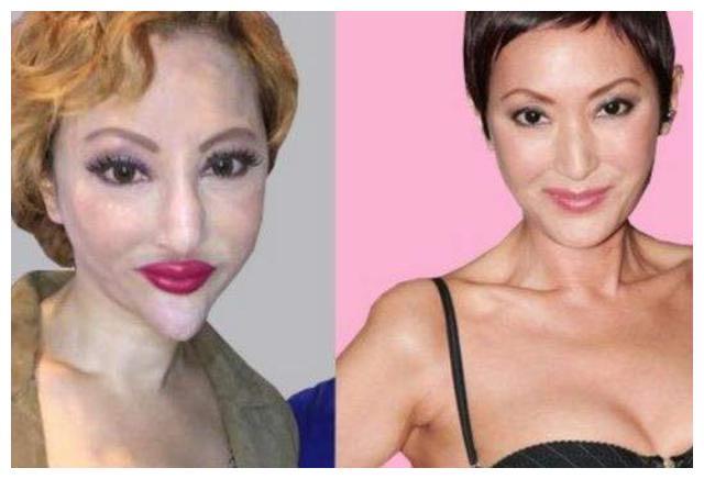 「整容」盘点被整容毁掉的女明星，萧蔷王祖贤郑裕玲，面目全非成毁容！