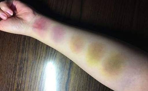 |为何说人死后不能摸尸体的脸，验尸官告诉你：不是迷信，而是科学