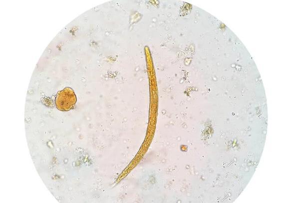 「」这些美食暗藏太多寄生虫，尽量不要碰，别吃出毛病了才后悔！