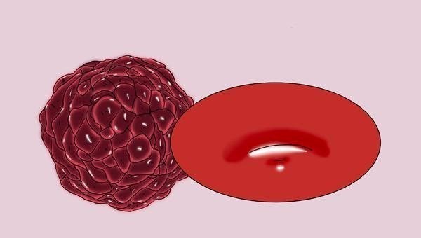 癌细胞|癌细胞不会突然转移，手脚频繁出现异象，可能是癌扩散了，多留意