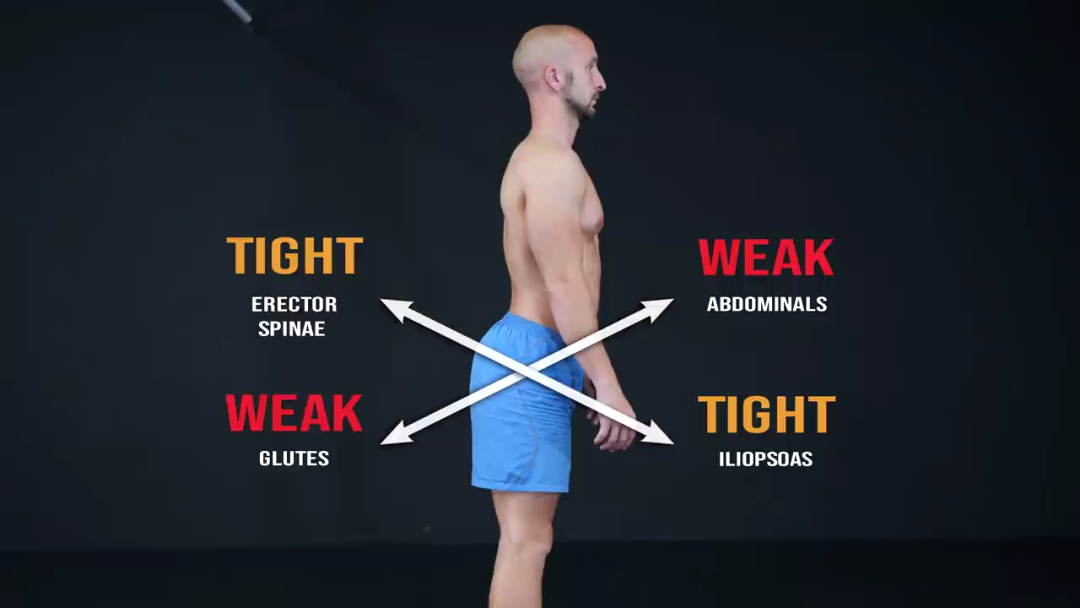 运动|腰背疼最不能练的3个动作&最适合的5个动作，别再瞎练了！