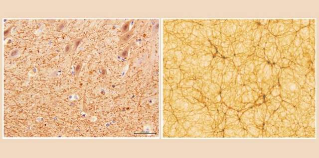 科学家|科学家发现人脑和宇宙有惊人相似性，难道宇宙是一个大脑？