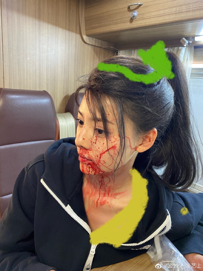 【迪丽热巴】黄景瑜前妻王雨馨凌晨自杀，两人已离婚两年，迪丽热巴新剧被影响