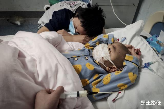骨髓移植：河南一5岁男童被医生禁食6个月仅剩28斤，靠24小时输营养液保命