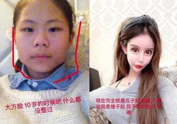 整容|13岁女孩为当网红，3年整容60次花费百万，如今她怎么样了？