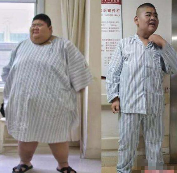 钱枫|体重668斤，被称是中国第一胖子的王浩楠，为爱减肥一年内瘦400斤