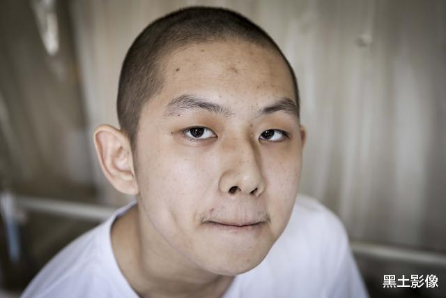 #河北#河北15岁少年患重症连续咳血20多天，撑到手术前却欲放弃：我累了