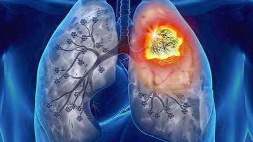 排便|每天吸烟的人，若身上这3个地方没“变粗”，恭喜你的肺还算健康