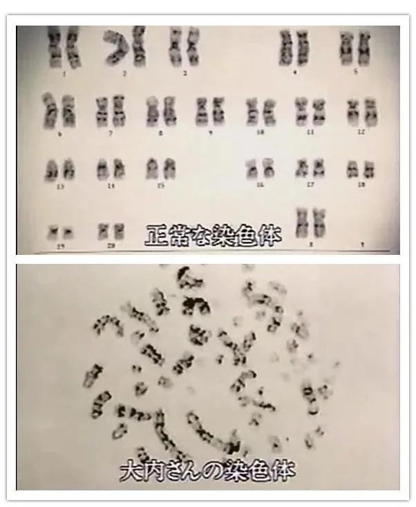 核辐射|核辐射为啥那么恐怖?全身DNA断裂的后果,可能超乎你的想象