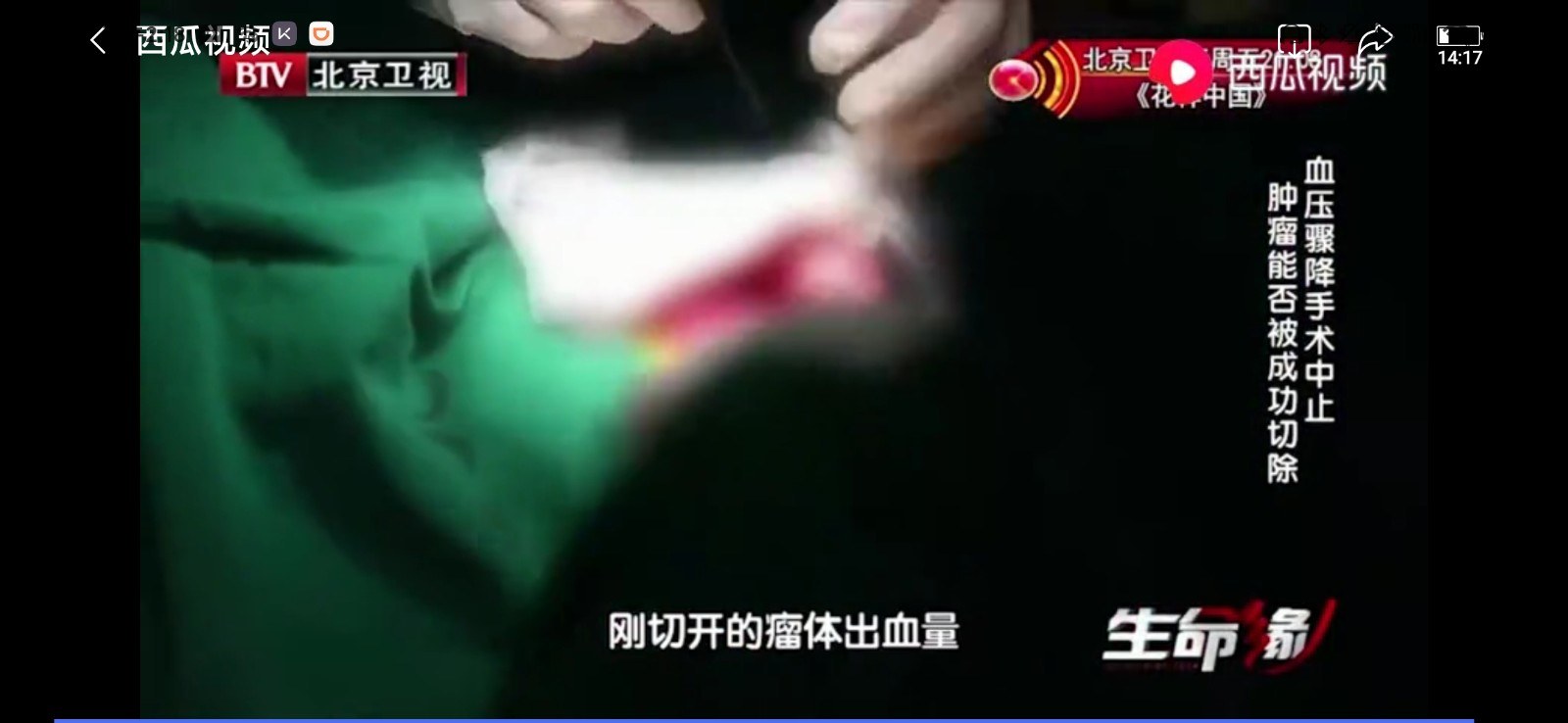 医生|9岁女童腹痛难忍，确诊癌症之王！医生告诫家长：3件事不要忽视