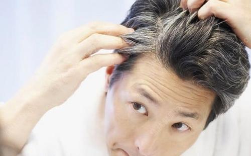 『白发』“白发”越拔越多？白发不能染，会致癌？医生说出了真相，要了解