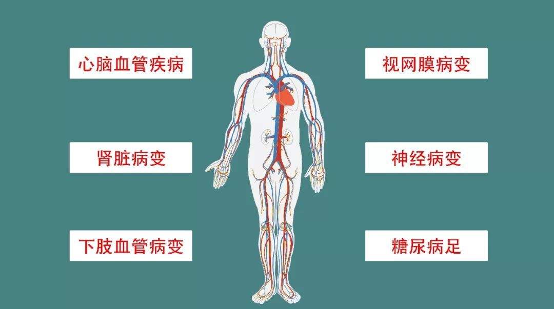 高血脂|空腹血糖和餐后血糖,哪个更重要?