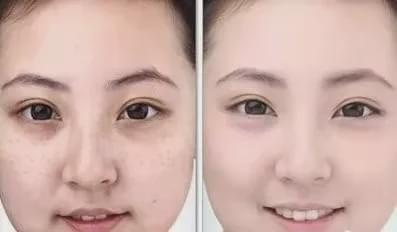 林心如|84斤谭松韵意外暴露120斤粗腿，但她单凭这点就吊打10个奚梦瑶！