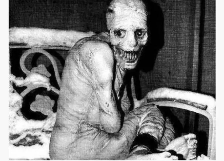 科学家|恐怖的苏联睡眠实验告诉你不睡觉有多可怕，你还敢熬夜吗？