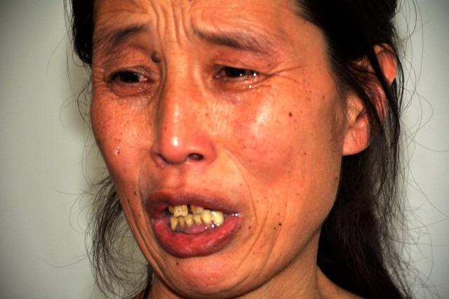 [肝脏]44岁女子，查出肝癌，不只喝酒伤肝，4件事做太多，肝也受不了