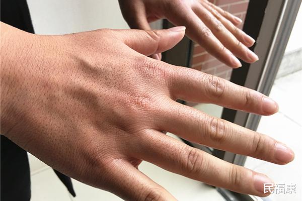 医生|男人经常做3件小事，阳气迟早消失殆尽，医生：60%的人还没改