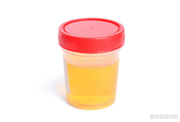 肝脏|肝不好，会出现4个异常，除了喝酒，这3类食物，再喜欢也要少碰