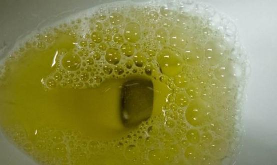 尿酸|“高嘌呤”食物列表已统计，尿酸高的人尽量挑着吃，看完收藏一下