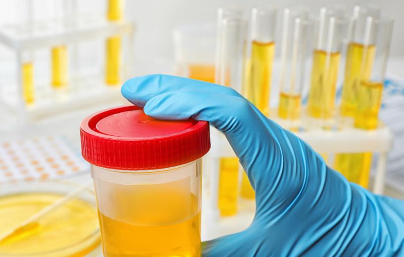 「肝脏」肝脏出现问题,晨起后会有这几个异常,一个不占的可以放心了