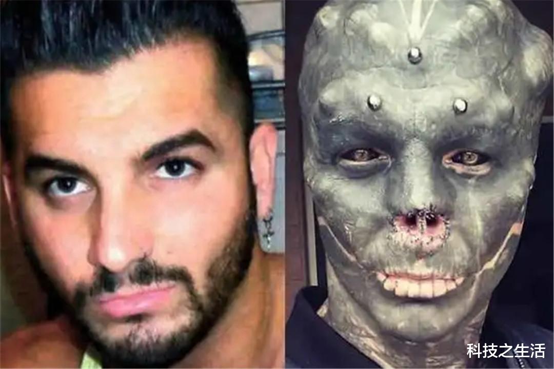 白矮星|法国男子为让自己变成“外星人”，做多项手术，如今的模样令人惋惜！