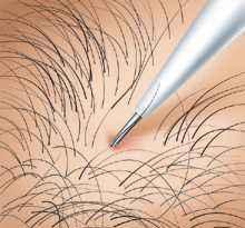 「疾病」身体这4个地方的毛发越旺盛,说明身体越健康,不是一件自卑的事