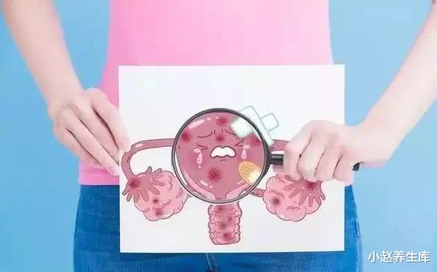 「宫颈癌」一旦内裤出现这种异常，可能是宫颈癌“找上门”，女性要注意！