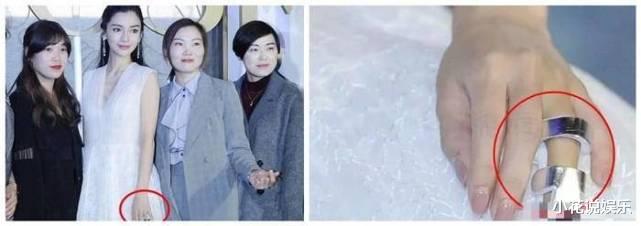 明星|明星上综艺意外频频，热巴、杨颖均未幸免，最后一位竟当场过世！