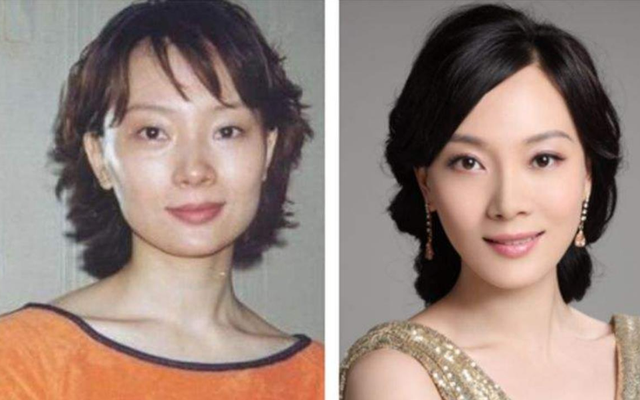 林志玲|有种“整容”叫出嫁14个月，黑泽一点没变，林志玲却判若两人！