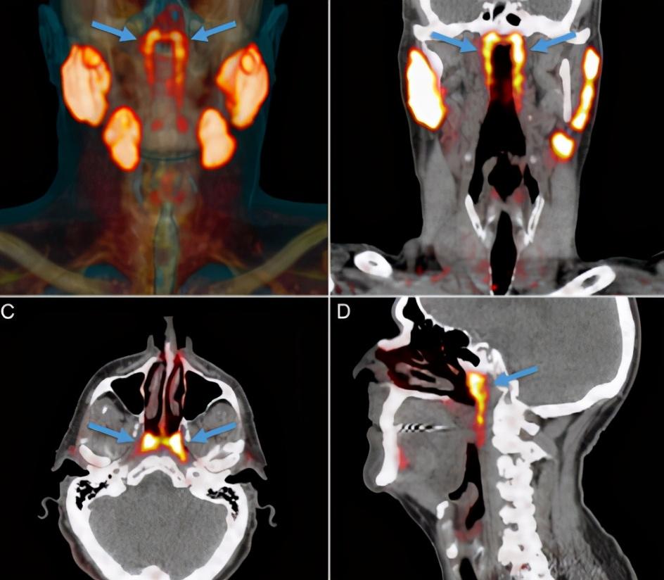 科学家|科学家在癌症患者身上，发现了一个新器官，对癌症治疗有极大的帮助