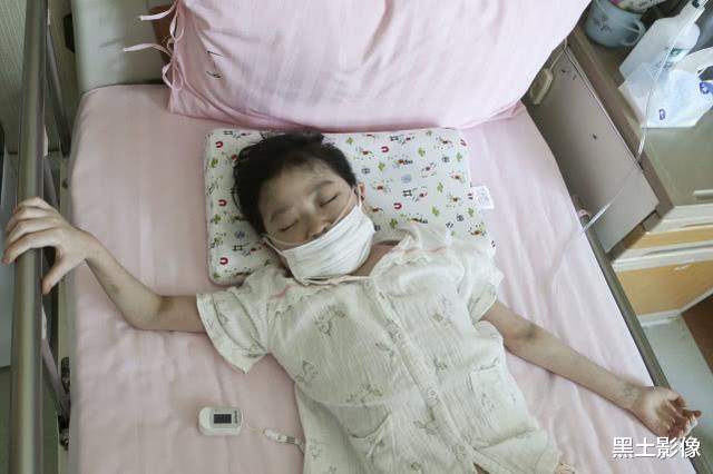 小姐姐▲湖北9岁女孩肺部“薄如纸片”体重仅有22公斤,胳膊腿瘦如柴火棍
