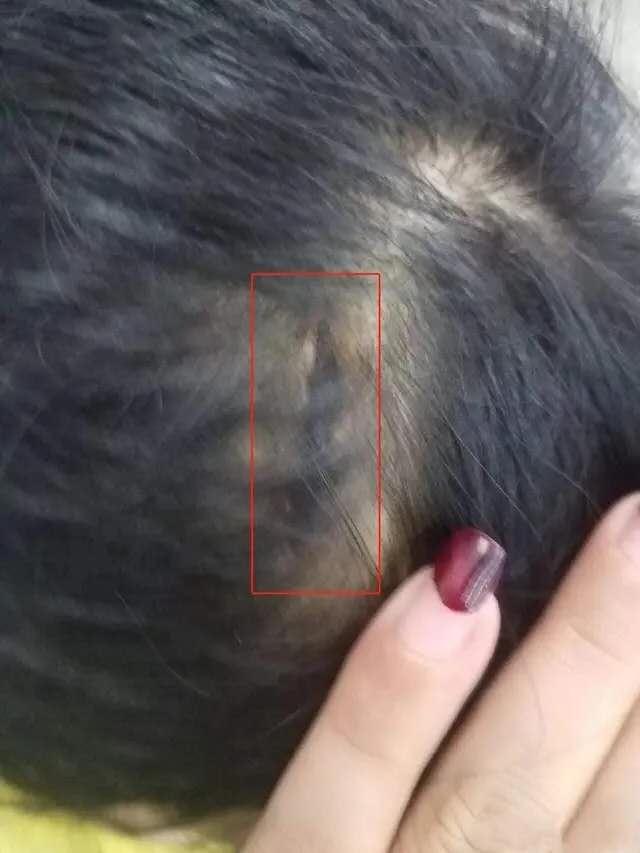 「城管」女子因家庭不睦，迁怒亲生女儿，因其不愿洗澡暴力殴打，致幼女下体重度撕裂！