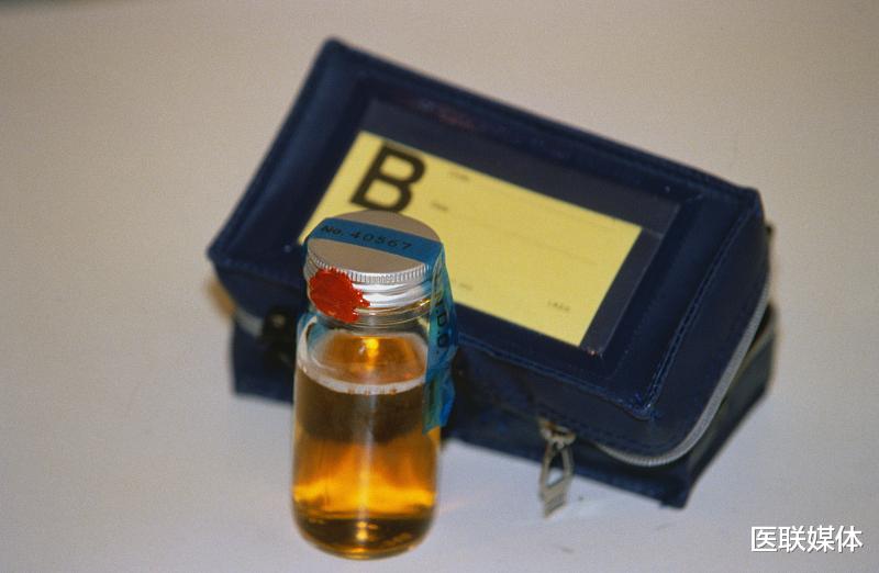 肾衰竭|肾衰竭“上门”前，身体或会发出4个“警报”，别到尿毒症才知道