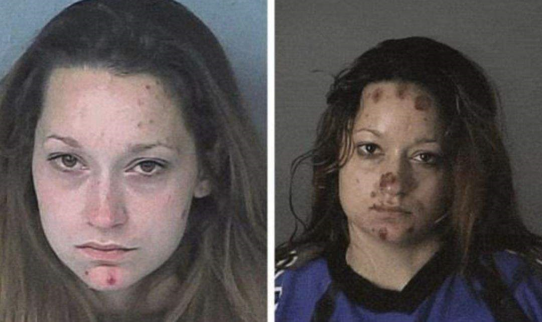 毁容|毒品多可怕？看看明星吸毒前后对比图，不仅毁容，还断送前程