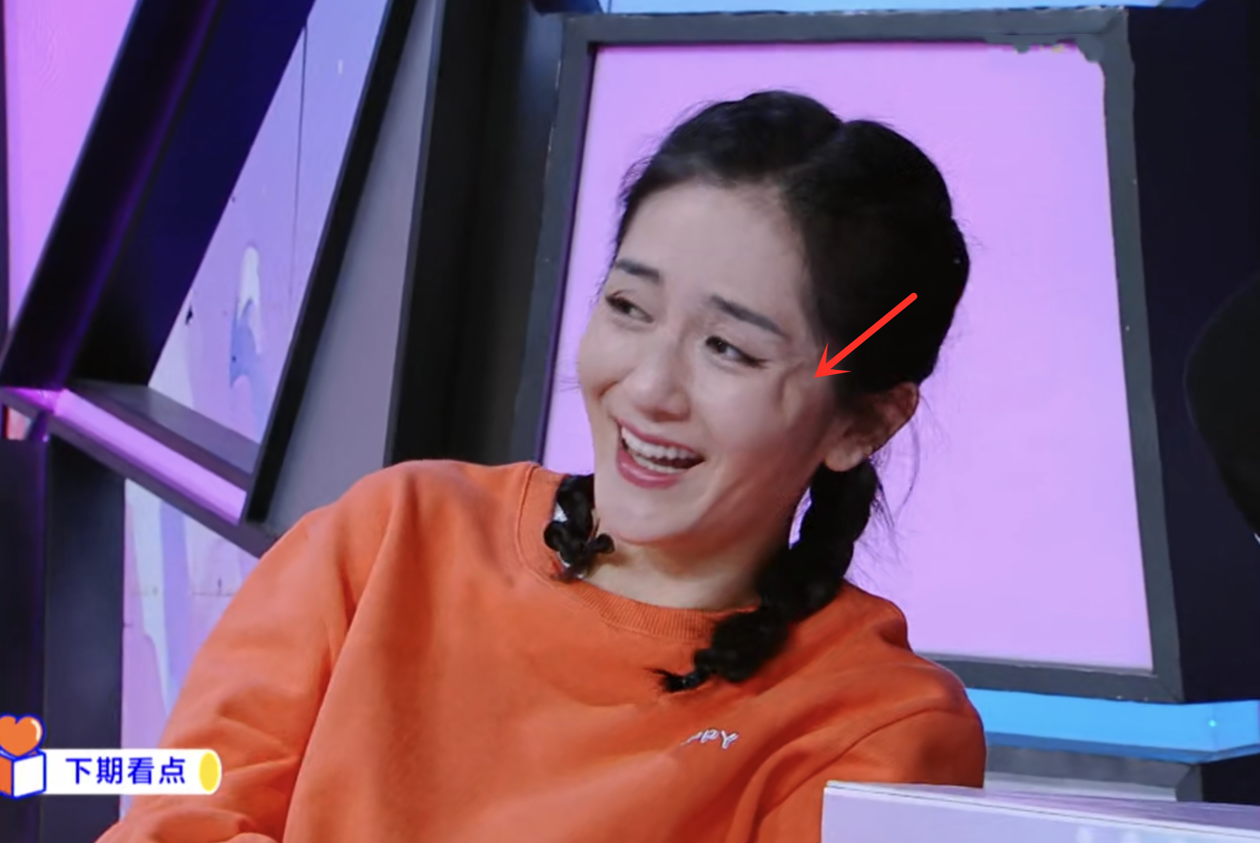 谢娜|谢娜的脸怎么了？笑起来眼角出现奇怪大坑，引网友整容猜疑