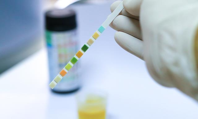 尿酸|52岁男子，尿酸值从589到253，或和坚持了4个习惯有关