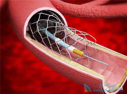 医院|“人都死了，药还堆积如山”，人民日报揭露“谋财害命”的过度医疗