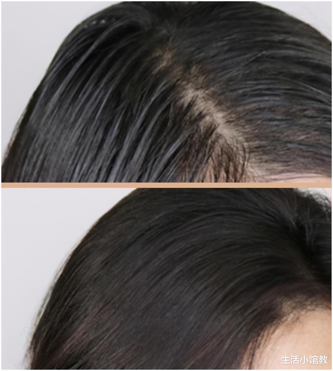 洗发水|央视曝光：这4种洗发水建议不要买，虽然销量高却存在很多问题