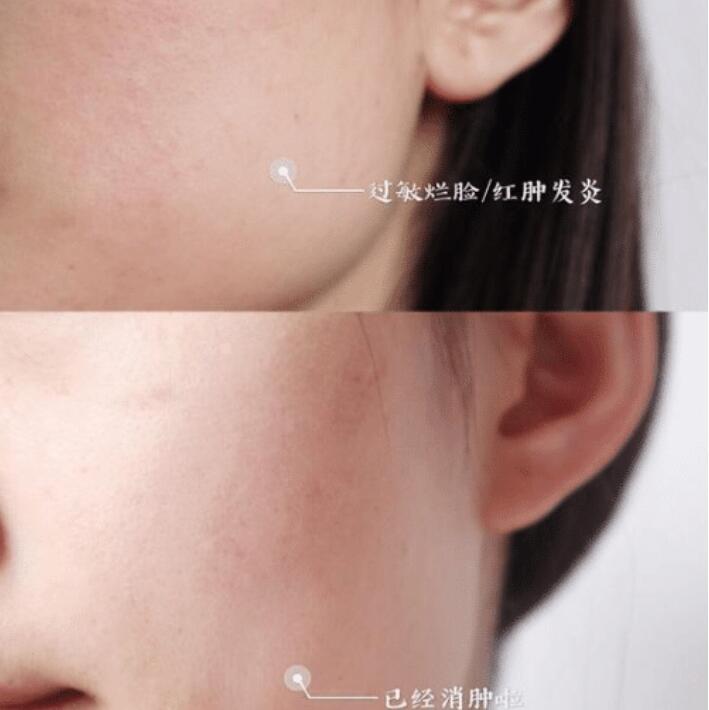 面霜 袁咏仪晒出自用的“抗老”面霜，却因价低被看不起，网友：敏感暗沉没了