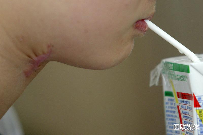 [疾病]寿命短的男人，身上多有“2大1小”，你若也有，麻烦重视