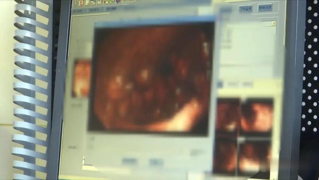 清苑：“血都是飙出来的！”8岁男童半夜血染床单，竟是这个东西掉出来了……