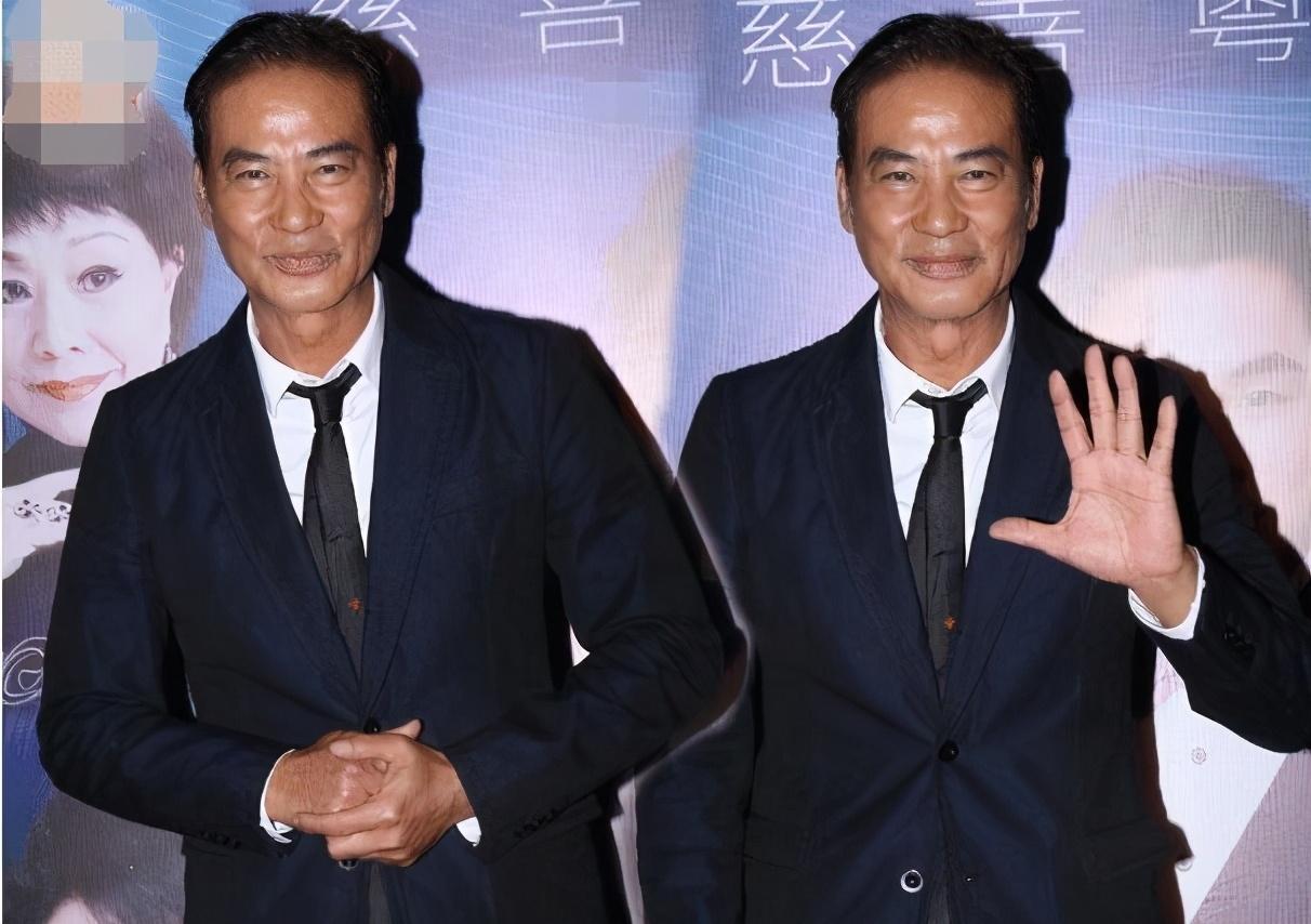 阿娇|阿娇发文报平安，公开额头伤口缝针照，近照憔悴消瘦让人心疼