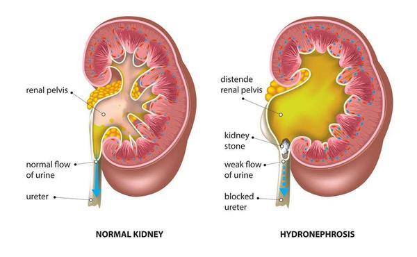 「贫血」肾好不好，看身体这十个变化！若超过3个，警惕肾脏或已发生病变