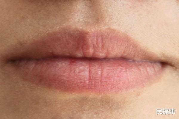 肝脏|肝脏不好的人，嘴巴会浮现4点异常，哪怕中了一个，也要赶紧养肝