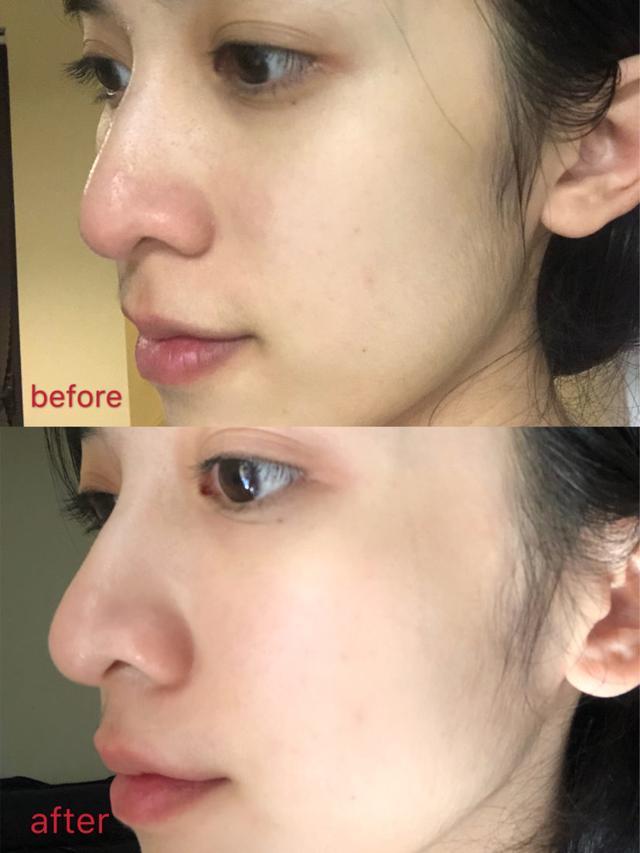 唐艺昕：有一种少女叫唐艺昕怀孕，晒出“续命”精华，张嘉倪：平价兰蔻