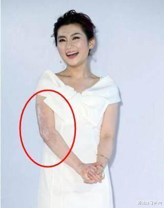 Selina:毁容的Selina以为找到真爱,结婚后又被迫离婚,背后真相让人心酸