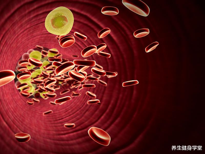 高血脂|血液粘稠和高血脂不一样,若身体有2个信号,或许是血脂过高