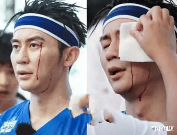 「迪丽热巴」明星在节目里能有多危险？热巴羞到逃走，李晨流血，而他在笑声中去世